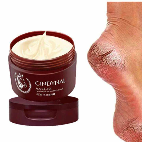 Foot Moisture Cream